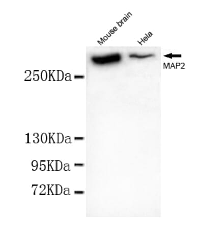 MAP2 (N-term) Monoclonal Antibody from Signalway Antibody (27037) - Antibodies.com