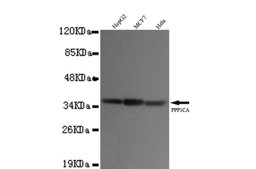 PP1A (N-term) Monoclonal Antibody from Signalway Antibody (27058) - Antibodies.com