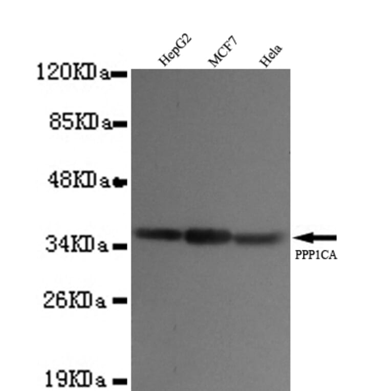 PP1A (N-term) Monoclonal Antibody from Signalway Antibody (27058) - Antibodies.com