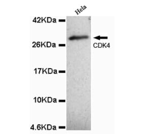 CDK4 (N-term) Monoclonal Antibody from Signalway Antibody (27070) - Antibodies.com