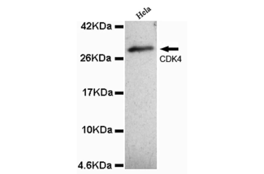 CDK4 (N-term) Monoclonal Antibody from Signalway Antibody (27070) - Antibodies.com