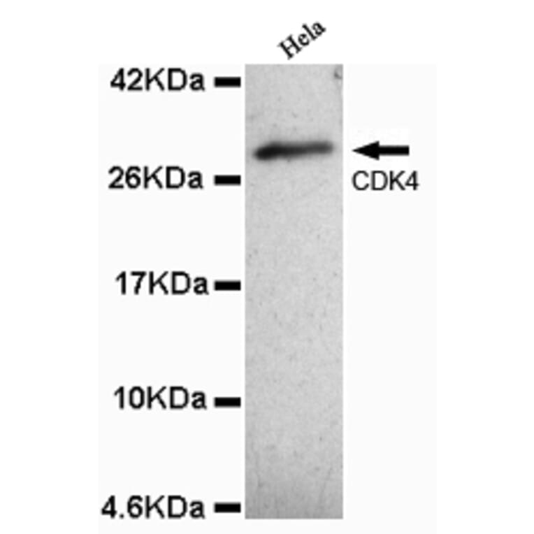 CDK4 (N-term) Monoclonal Antibody from Signalway Antibody (27070) - Antibodies.com