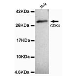 CDK4 (N-term) Monoclonal Antibody from Signalway Antibody (27070) - Antibodies.com