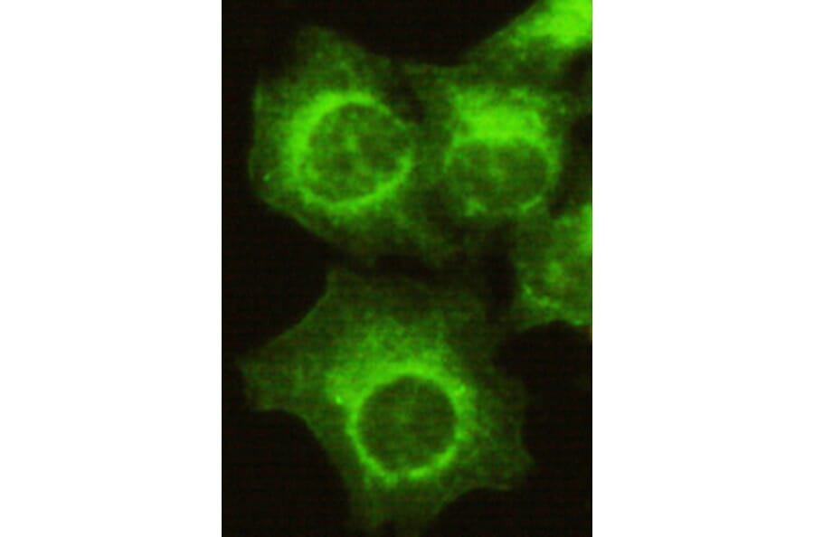 CDK4 (N-term) Monoclonal Antibody from Signalway Antibody (27070) - Antibodies.com