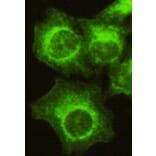 CDK4 (N-term) Monoclonal Antibody from Signalway Antibody (27070) - Antibodies.com