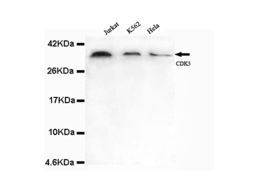 CDK5 (N-term) Monoclonal Antibody from Signalway Antibody (27072) - Antibodies.com