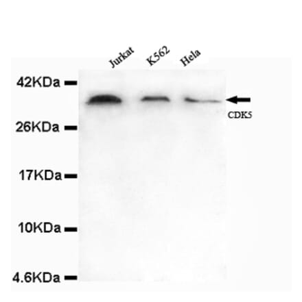 CDK5 (N-term) Monoclonal Antibody from Signalway Antibody (27072) - Antibodies.com