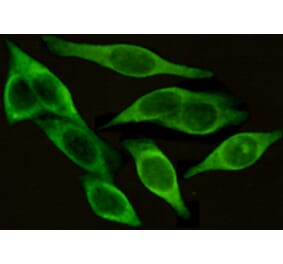 Immunocytochemistry - CD54 (ICAM-1) Monoclonal Antibody from Signalway Antibody (27176) - Antibodies.com