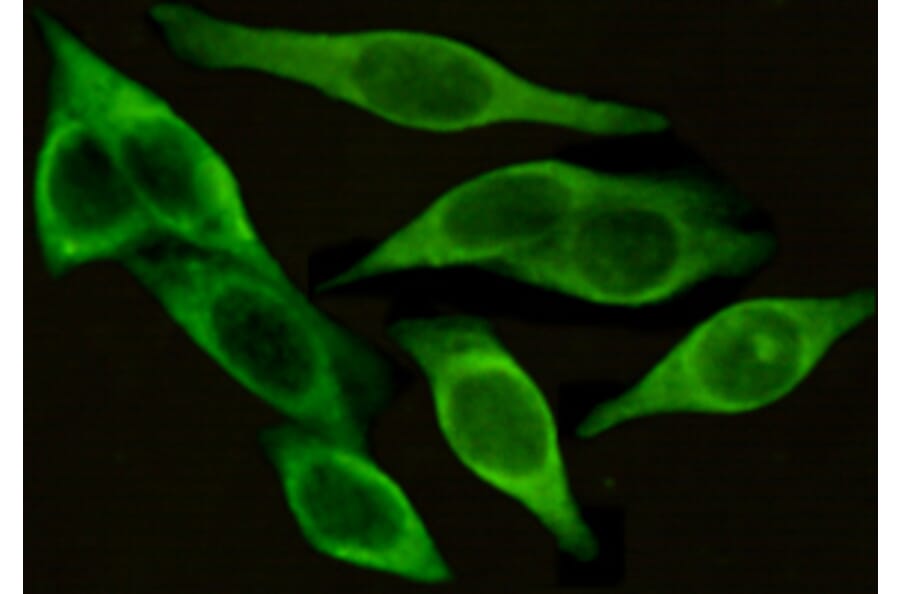 Immunocytochemistry - CD54 (ICAM-1) Monoclonal Antibody from Signalway Antibody (27176) - Antibodies.com