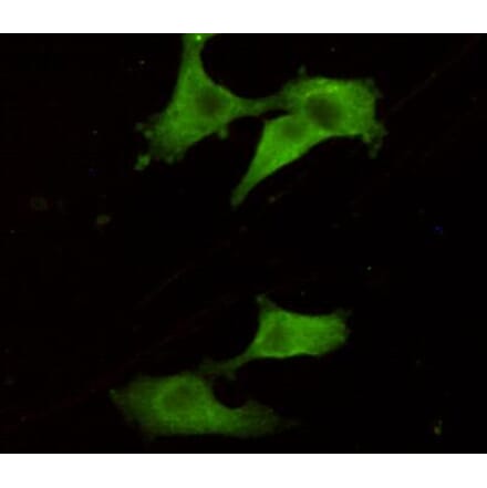 Immunocytochemistry - UCHL1/PGP9.5 Monoclonal Antibody from Signalway Antibody (27188) - Antibodies.com