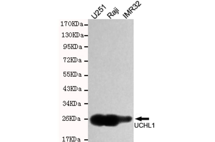 Western blot - UCHL1/PGP9.5 Monoclonal Antibody from Signalway Antibody (27188) - Antibodies.com