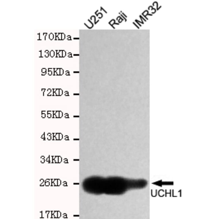 Western blot - UCHL1/PGP9.5 Monoclonal Antibody from Signalway Antibody (27188) - Antibodies.com