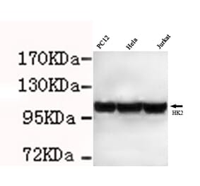Hexokinase-2 ( N-term) Monoclonal Antibody from Signalway Antibody (27074) - Antibodies.com