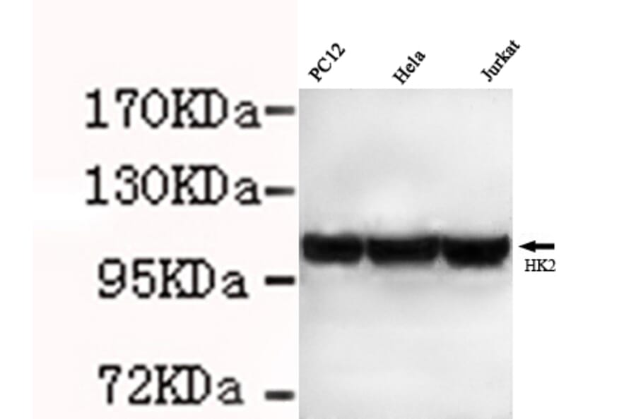 Hexokinase-2 ( N-term) Monoclonal Antibody from Signalway Antibody (27074) - Antibodies.com