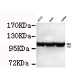 Hexokinase-2 ( N-term) Monoclonal Antibody from Signalway Antibody (27074) - Antibodies.com