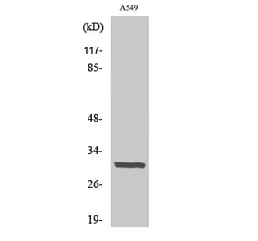 Western blot - Adiponectin Polyclonal Antibody from Signalway Antibody (40505) - Antibodies.com