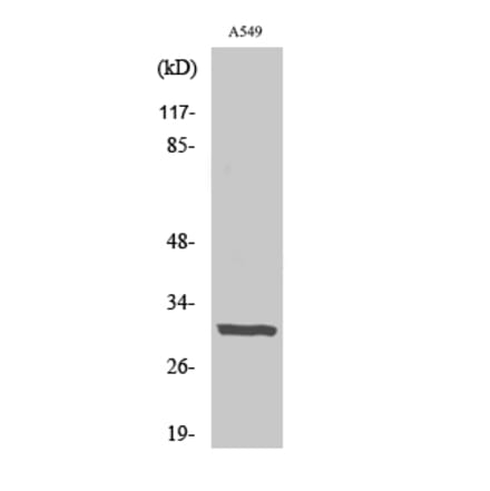 Western blot - Adiponectin Polyclonal Antibody from Signalway Antibody (40505) - Antibodies.com