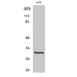 Western blot - Adiponectin Polyclonal Antibody from Signalway Antibody (40505) - Antibodies.com