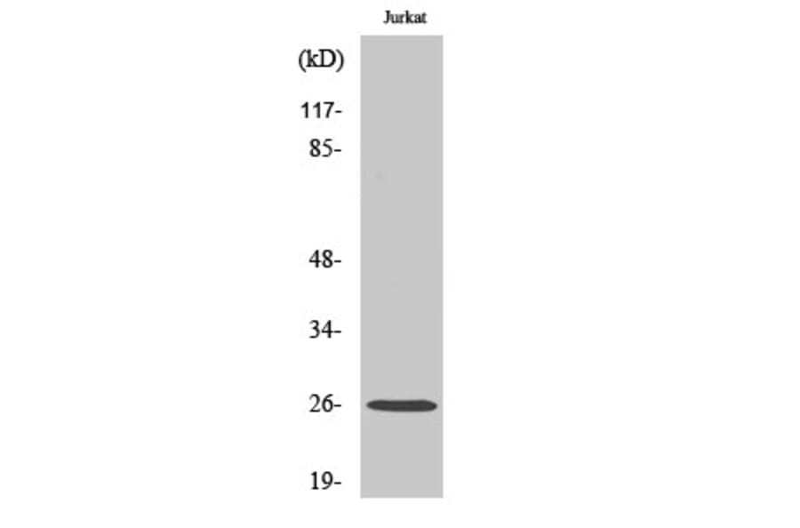 Western blot - Connexin-26 Polyclonal Antibody from Signalway Antibody (40778) - Antibodies.com