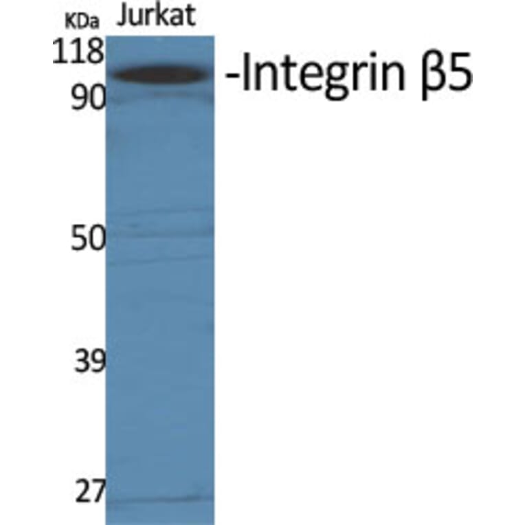 Western blot - Integrin β5 Polyclonal Antibody from Signalway Antibody (41071) - Antibodies.com
