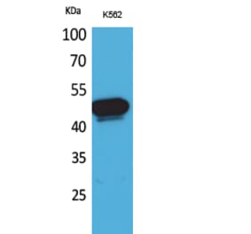 Western blot - Kallistatin Polyclonal Antibody from Signalway Antibody (41624) - Antibodies.com