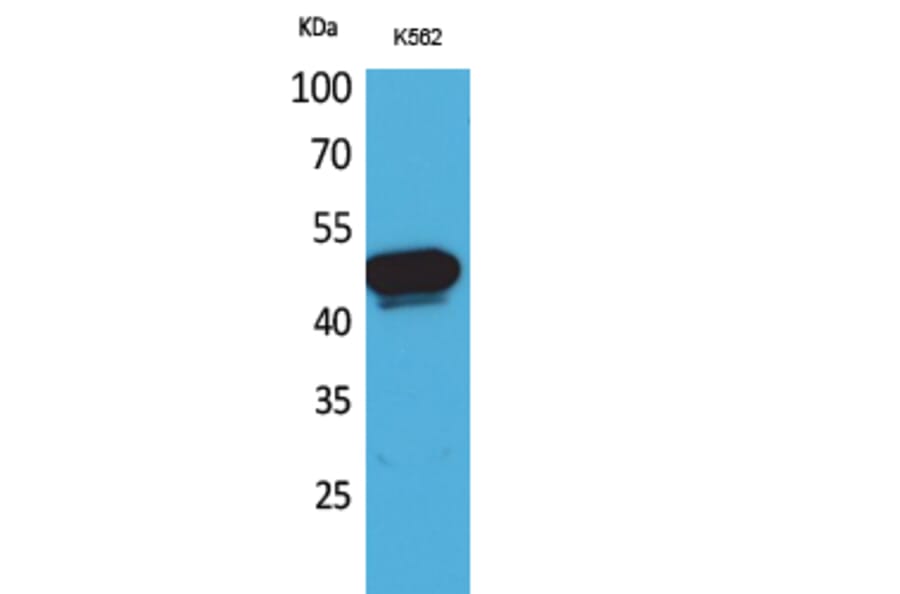 Western blot - Kallistatin Polyclonal Antibody from Signalway Antibody (41624) - Antibodies.com