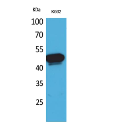 Western blot - Kallistatin Polyclonal Antibody from Signalway Antibody (41624) - Antibodies.com