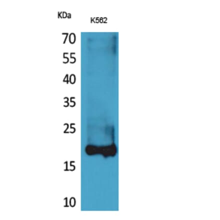 Western blot - Lipocalin-1 Polyclonal Antibody from Signalway Antibody (41627) - Antibodies.com