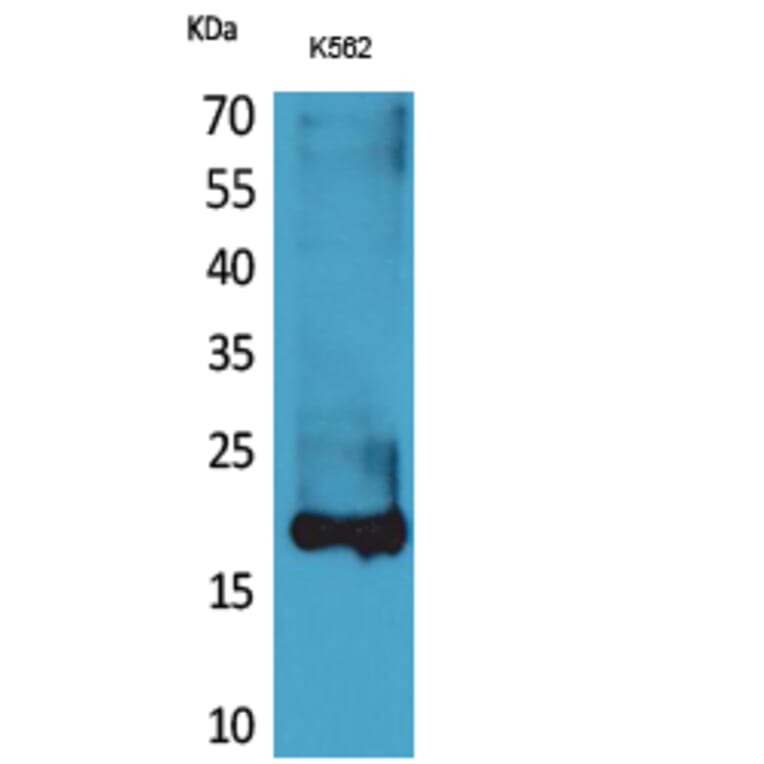Western blot - Lipocalin-1 Polyclonal Antibody from Signalway Antibody (41627) - Antibodies.com