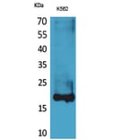 Western blot - Lipocalin-1 Polyclonal Antibody from Signalway Antibody (41627) - Antibodies.com