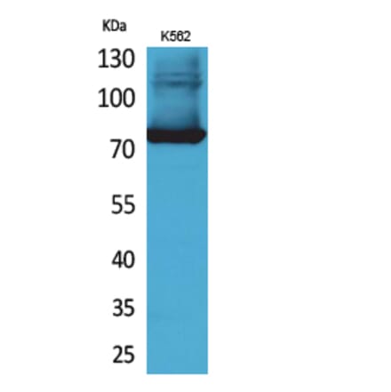 Western blot - Transferrin Polyclonal Antibody from Signalway Antibody (41645) - Antibodies.com