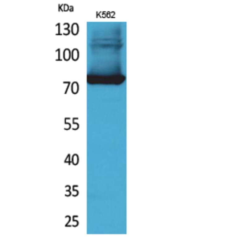 Western blot - Transferrin Polyclonal Antibody from Signalway Antibody (41645) - Antibodies.com