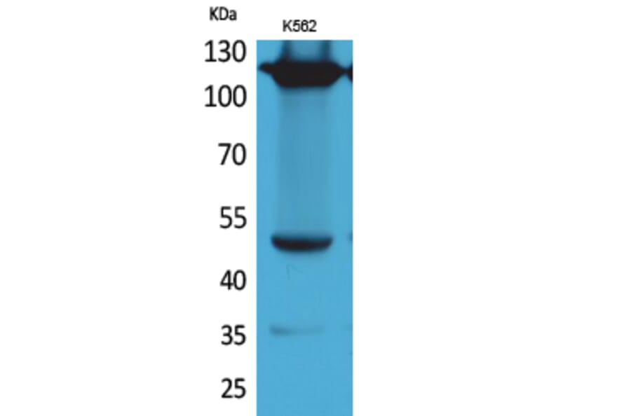 Western blot - Integrin α4 Polyclonal Antibody from Signalway Antibody (41655) - Antibodies.com