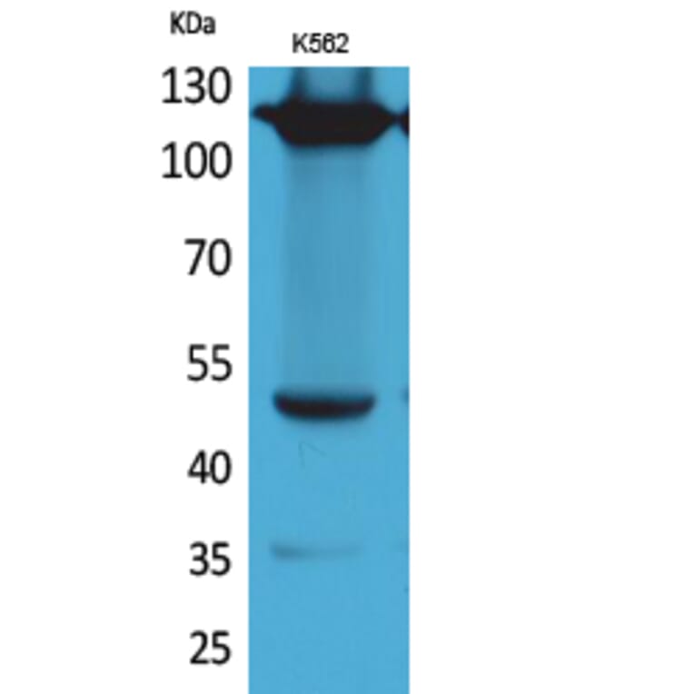 Western blot - Integrin α4 Polyclonal Antibody from Signalway Antibody (41655) - Antibodies.com