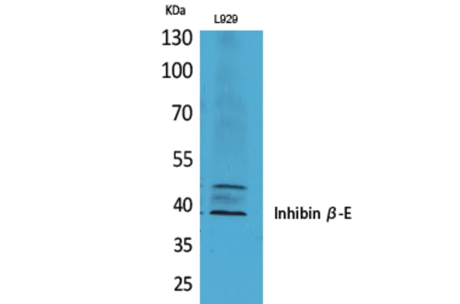 Western blot - Inhibin β-E Polyclonal Antibody from Signalway Antibody (41705) - Antibodies.com