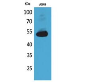 Western blot - Annexin VII Polyclonal Antibody from Signalway Antibody (41760) - Antibodies.com