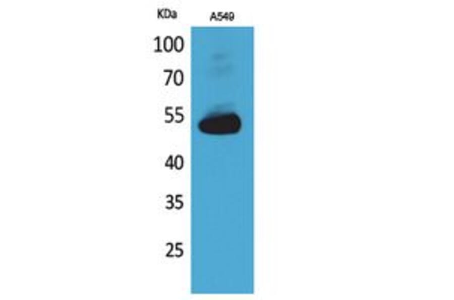 Western blot - Annexin VII Polyclonal Antibody from Signalway Antibody (41760) - Antibodies.com