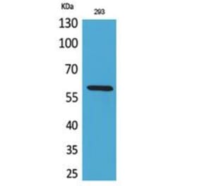 Western blot - ALPP/ALPPL2 Polyclonal Antibody from Signalway Antibody (41762) - Antibodies.com