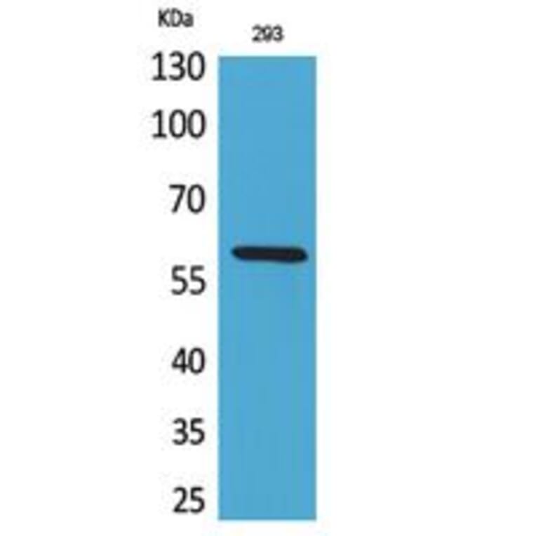 Western blot - ALPP/ALPPL2 Polyclonal Antibody from Signalway Antibody (41762) - Antibodies.com