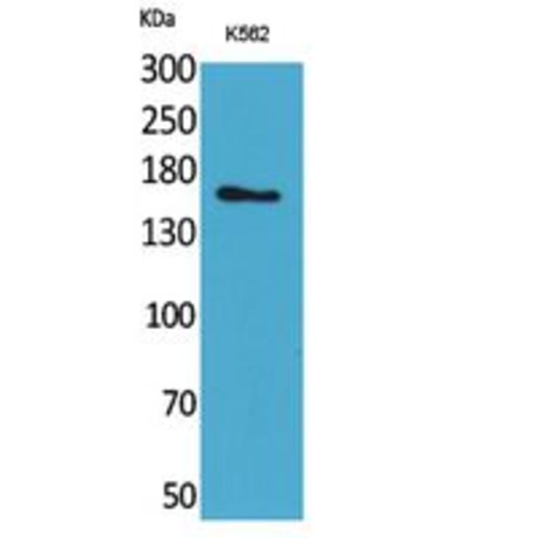 Western blot - Laminin γ-2 Polyclonal Antibody from Signalway Antibody (41766) - Antibodies.com