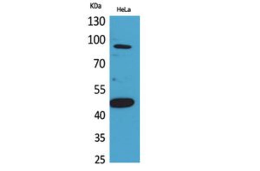 Western blot - Inhibin β-B Polyclonal Antibody from Signalway Antibody (41793) - Antibodies.com