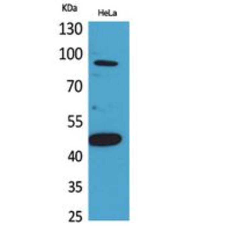 Western blot - Inhibin β-B Polyclonal Antibody from Signalway Antibody (41793) - Antibodies.com