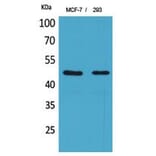 Western blot - Inhibin β-A Polyclonal Antibody from Signalway Antibody (41794) - Antibodies.com