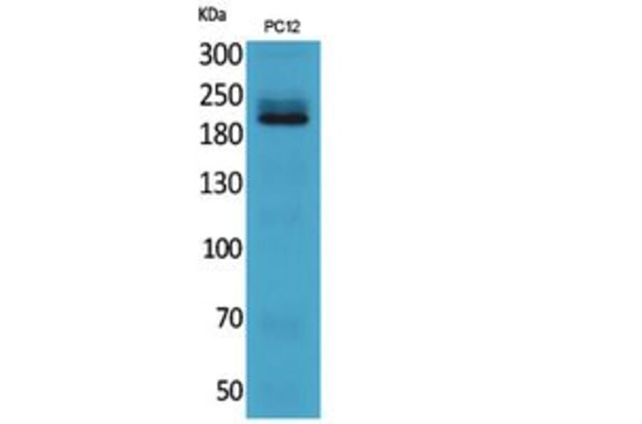 Western blot - Integrin β4 Polyclonal Antibody from Signalway Antibody (41840) - Antibodies.com