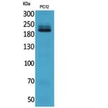 Western blot - Integrin β4 Polyclonal Antibody from Signalway Antibody (41840) - Antibodies.com