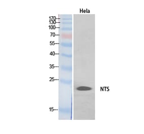 Western blot - Neurotensin Polyclonal Antibody from Signalway Antibody (41902) - Antibodies.com