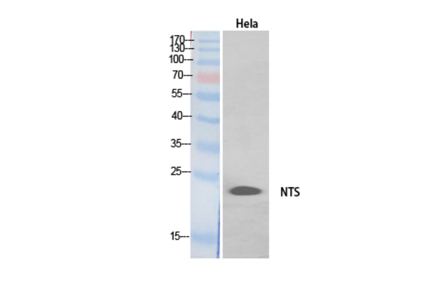 Western blot - Neurotensin Polyclonal Antibody from Signalway Antibody (41902) - Antibodies.com
