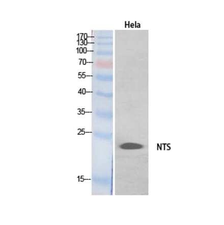 Western blot - Neurotensin Polyclonal Antibody from Signalway Antibody (41902) - Antibodies.com