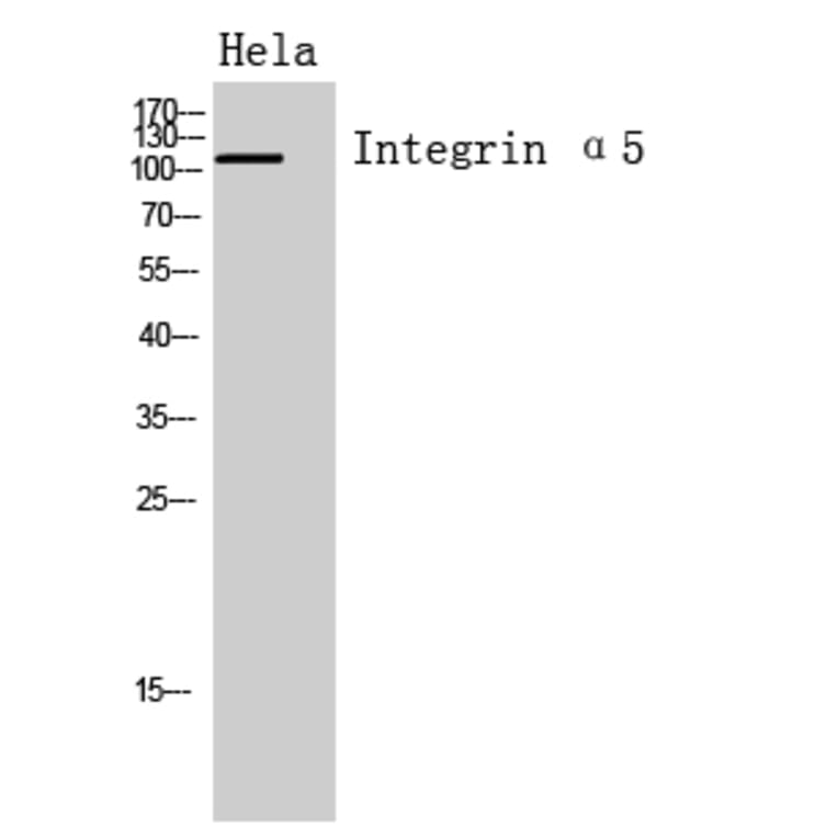 Western blot - Integrin α5 Polyclonal Antibody from Signalway Antibody (41954) - Antibodies.com