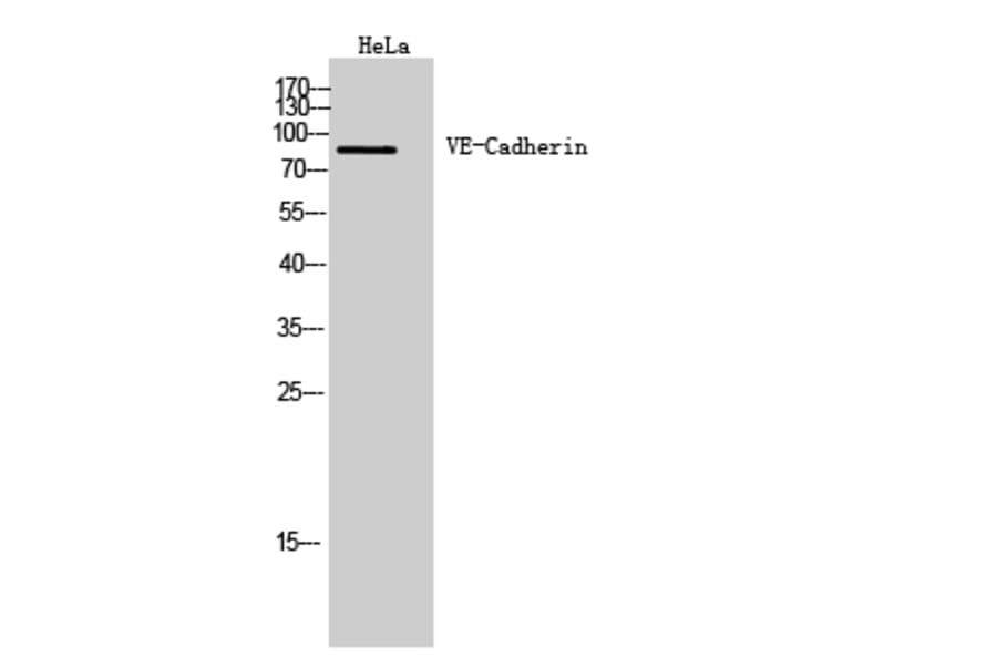 Western blot - VE-Cadherin Polyclonal Antibody from Signalway Antibody (41976) - Antibodies.com